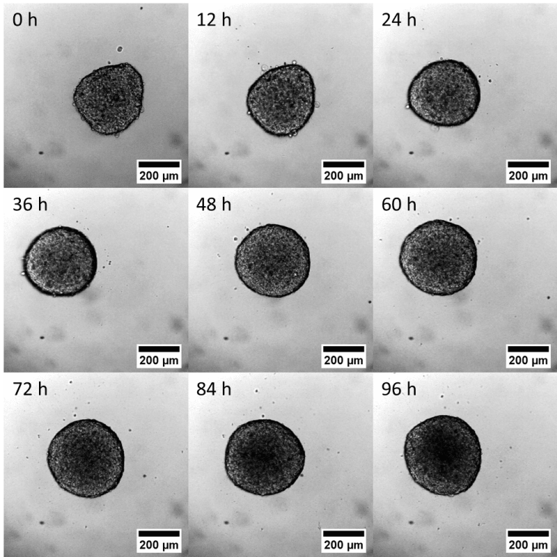 Timelapse-Imaging-of-Spheroids