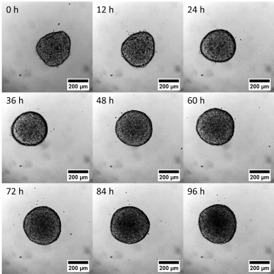 Timelapse-Imaging-of-Spheroids